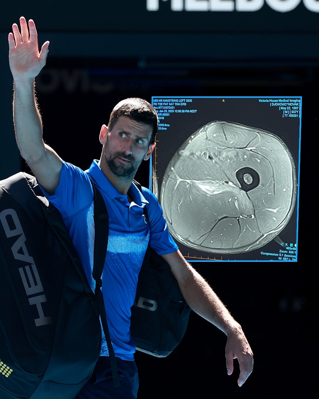 随机德约科维奇迎来十五赛季高光表现，美国队球迷沸腾！